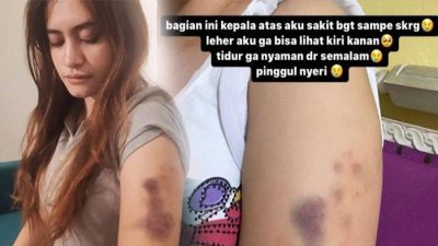 Pelanggaran Etika: Polwan Terlibat Penganiayaan Kekasih Adik di Riau