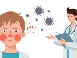 Campak Kembali Ramai Dibahas, Ini Gejala, Cara Penularan, dan Penanganannya Menurut Tenaga Kesehatan